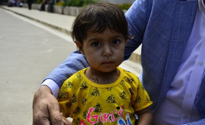 Kalbi delik ve damarları ters olan Aye bebek Türkiye’de sağlığına kavuştu