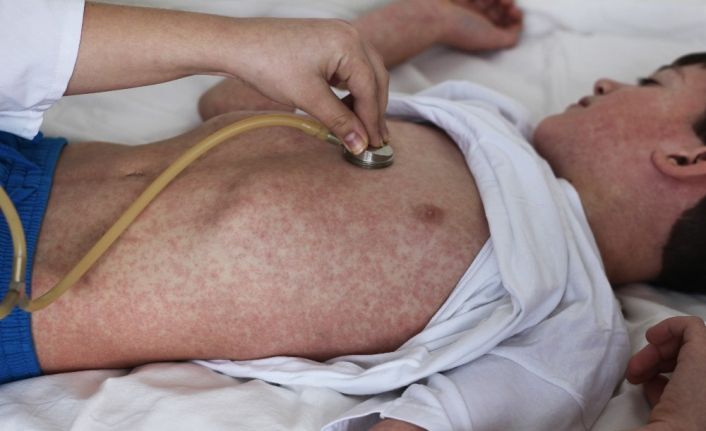 Dr. Öğretim Üyesi Özer Akgül: “Afrika kaynaklı Batı Nil Virüsü kuzeye doğru yayılıyor”