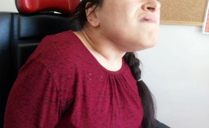 26 yaşındaki engelli hastanın çenesinin altından 38 cm büyüklüğünde tümör çıkarıldı