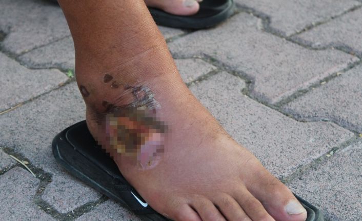 Aslan balığının zehirlediği balıkçı: "Bir daha yanından bile geçmem"