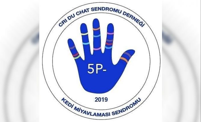 Cri du Chat Derneği üyeleri, çocuklarının yaşam kalitesini yükseltmek için destek bekliyor