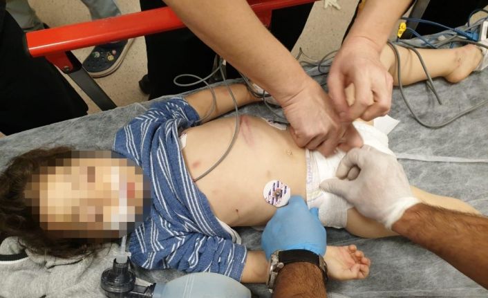 Üvey annenin komaya soktuğu küçük kıza devlet sahip çıktı