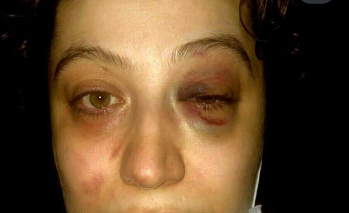 Eski eşi tarafından tehdit ve darp edilen kadın suç duyurusunda bulundu