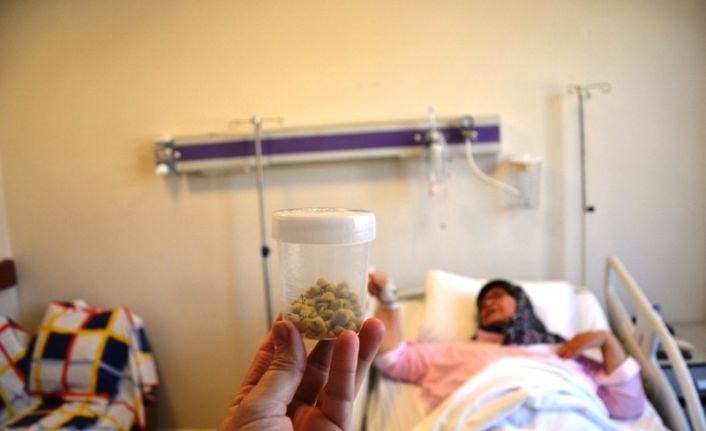 Safra kesesinden 80 taş çıktı