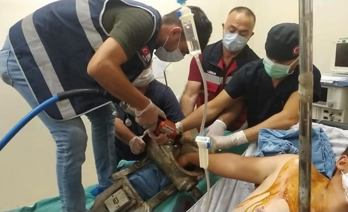 Eli salça makinasına sıkışan genç için doktorlar ve itfaiye seferber oldu
