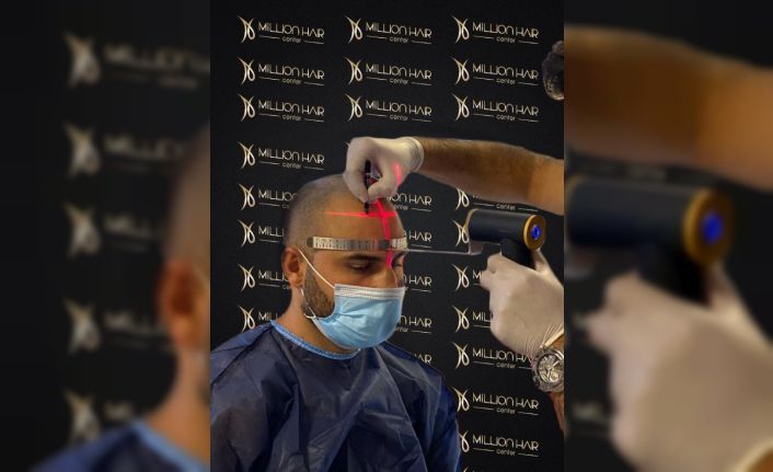 Million Hair Center CEO’ su Fatih Köse: ’’Saç ekiminin en önemli noktaları ön saç çizgisi ve doğal görünümdür’’
