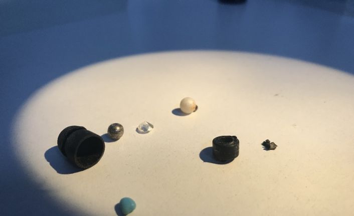 Kulak burun boğaz uzmanı Ali Fuat Şaşoğlu: “Hastanın burnundan 15 yıl sonra tespih boncuklarını çıkarttık”