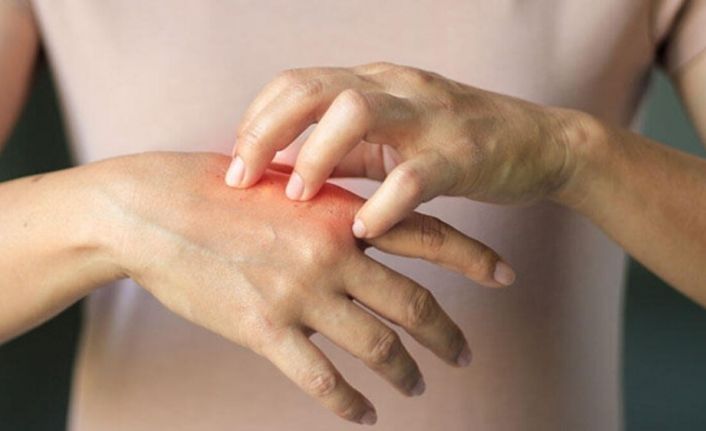 Uzmanlar aşırı dezenfektan kullanımı konusunda uyardı