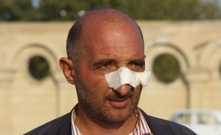 Berde’deki roketli saldırıda yüzünden yaralanan Ağalarov korku dolu anları anlattı