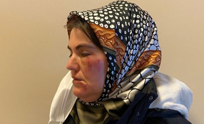 Maltepe’de korkunç olay: Sokak ortasında tanımadığı şahsın saldırısına uğradı