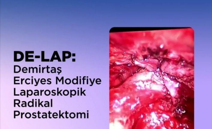 ERÜ’den Prostat Kanseri Tedavisinde Yerli Ve Milli Tedavi Yöntem: DE-LAP