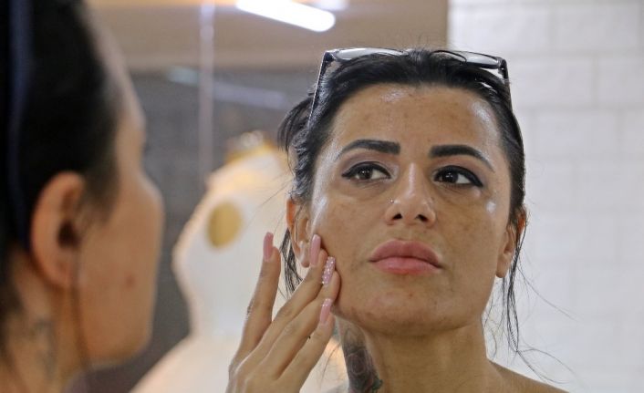 Güzelleşmek isterken yüzünde yanıklar oluşan kadın: "Gelin adaylarını görünce insanın psikolojisi bozuluyor"