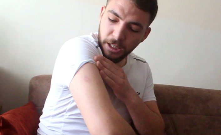 Patlayan cep telefonu yaraladı