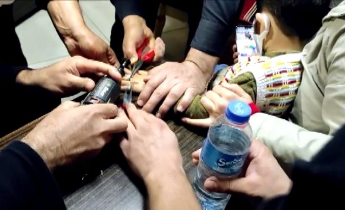 ‘Yüzük’ diye taktığı metal pulu itfaiye çıkarttı