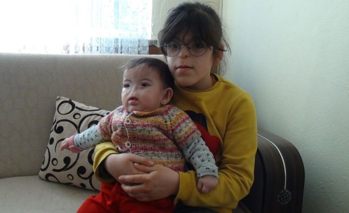 (Özel) Doğuştan buruları solunum yolları, burunları bulunmayan küçük kız kardeşlerin zorlu hayatı
