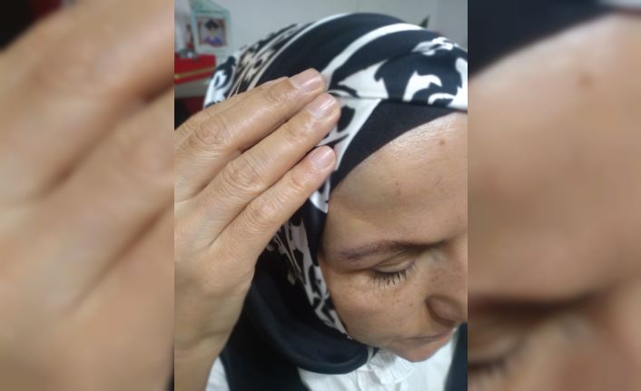 Gittiği bir iş yerinde çalışan tarafından darp edildiğini iddia eden kadın polise başvurdu