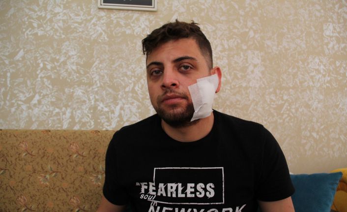 Kadına tokat attı diye uyardı, çatalla yüzünen yaralanıp hastanelik oldu