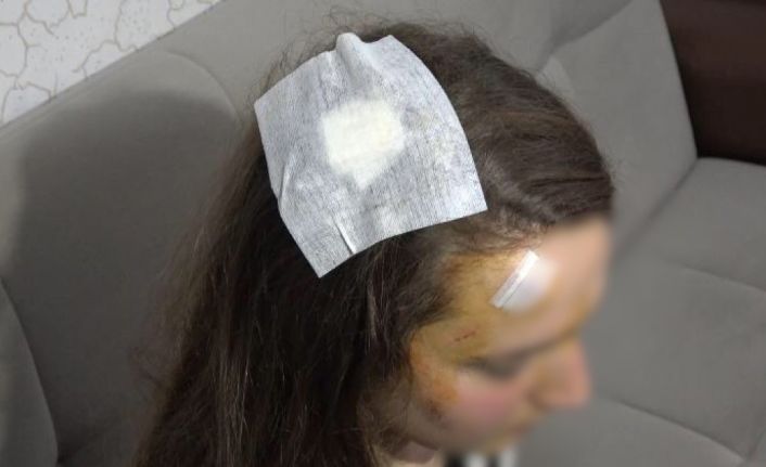 (Özel) Genç kız, tanımadığı kişi tarafından sokak ortasında ’Muşta’ ile darp edildi