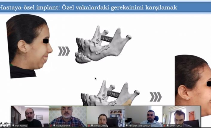 Prof. Dr. Kaymaz: “Hastanelerde ‘hastaya özel’ implant tasarımı ve imalat birimleri kurulmalı”