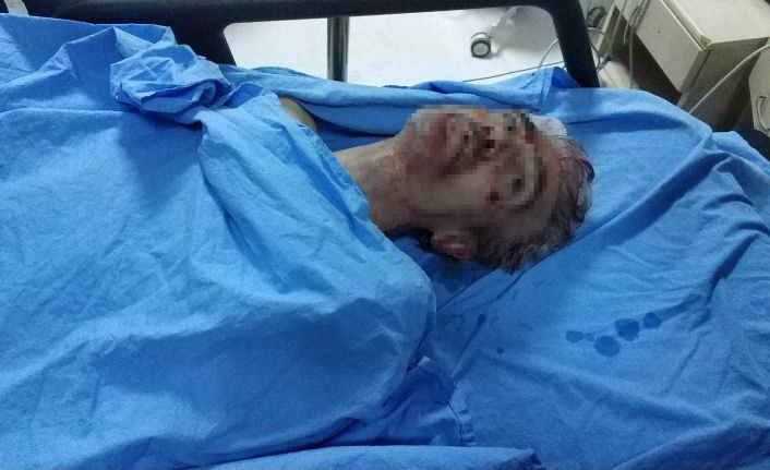 Samsun’daki silahlı saldırıda ölü sayısı 2’ye çıktı