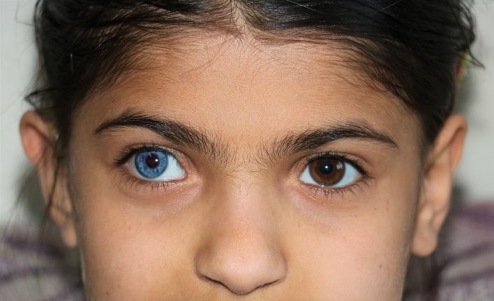 Yasin ve Elif kardeşler hayata çift renk bakıyor