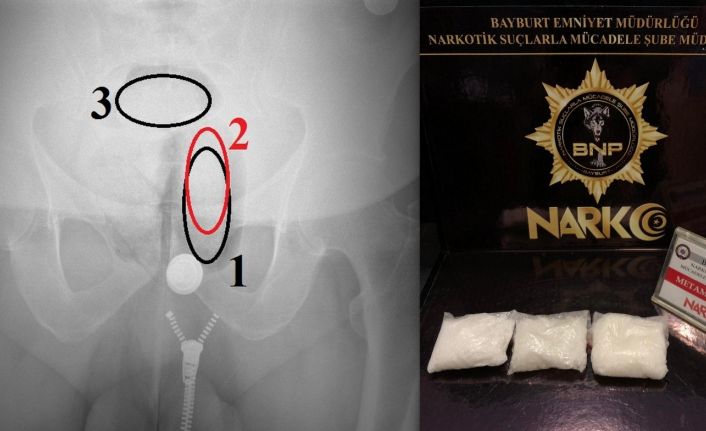 Bayburt’ta akıl almaz uyuşturucu zula etme yöntemini, polis röntgenle ortaya çıkardı