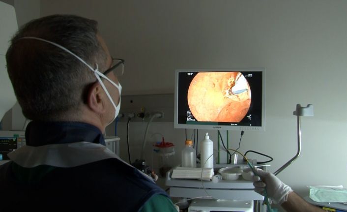 (ÖZEL) Başakşehir Şehir Hastanesi’nde ilk kez 3 yaşındaki çocuğa “ERCP” tedavisiyle uygulandı