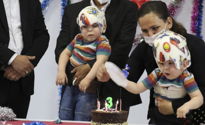 Ameliyatla ayrılan siyam ikizlerine doğum günü sürprizi