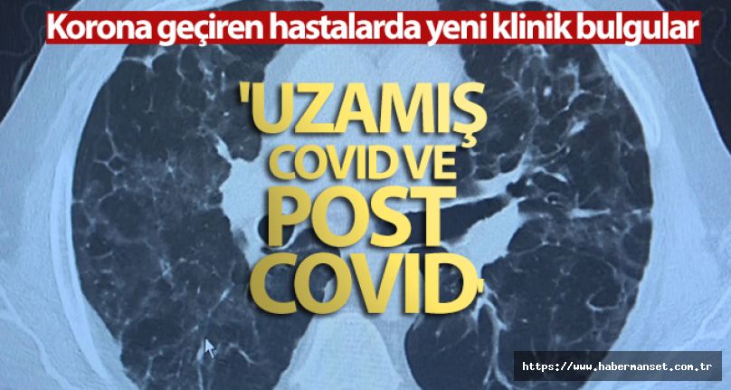 Covid Virüsü geçirenler de yeni bulgu:  'Uzamış Covid ve Post Covid'