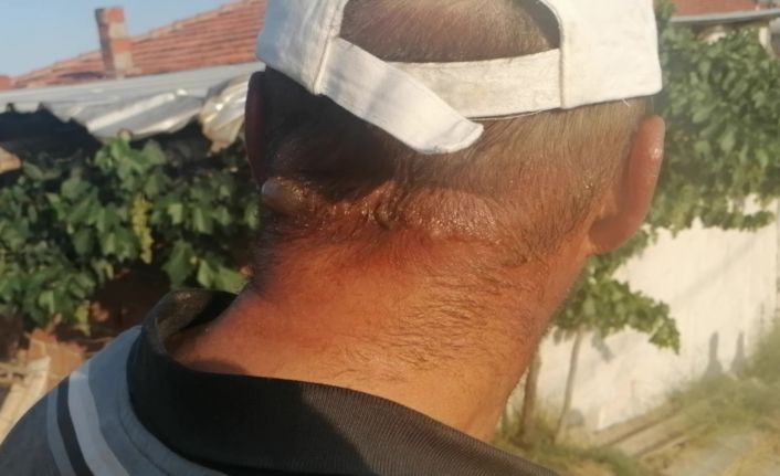 Borcunu yeni bitirdiği traktörünü alevlerin arasında bırakıp canını zor kurtardı