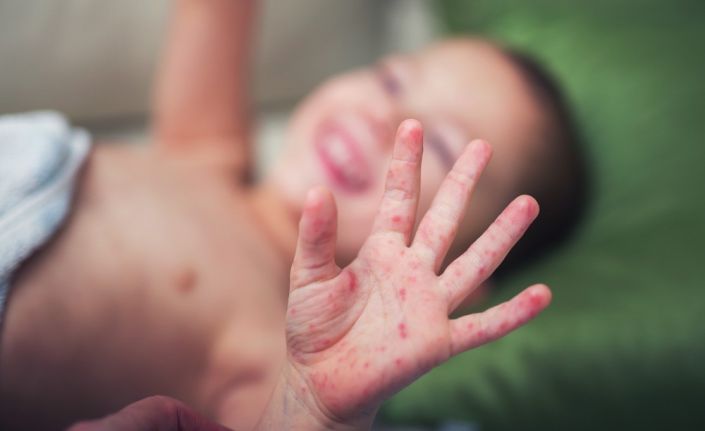 Bu hastalık hem çocuklar, hem de aileler için kabus oluyor