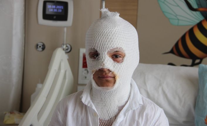 Camide çıkan yangını söndürmeye çalışırken kendisi yandı