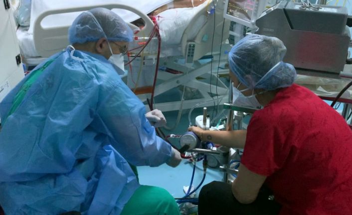 (Özel) Covid yoğun bakımında ECMO arıza yaptı, doktorların 2 saatlik elle müdahalesi hayat kurtardı
