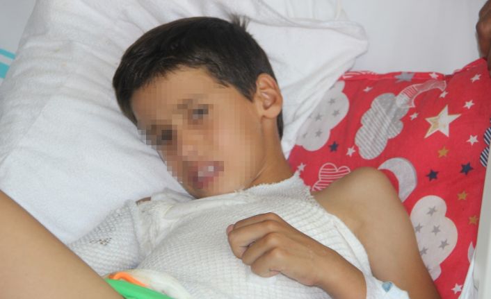 Sosyal medyadan görüp üzerine kolonya döktüğü ikizini yaktı