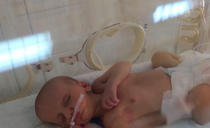 MHP ve AK Parti, doğuştan dudakları yapışık olan Umut bebek için seferber oldu