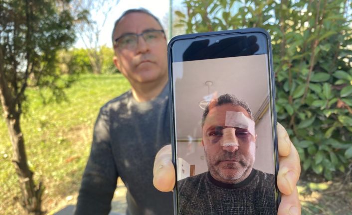 Fabrika işçisini öldüresiye darp edip, kendi sosyal medya hesabından böyle canlı yayınladılar