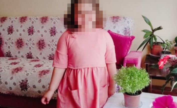 Küçük kızın vücudundaki morluklar iğrenç bir olayı ortaya çıkardı