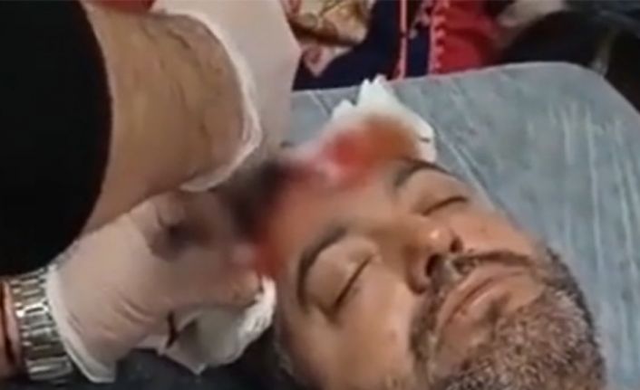 Avukata beyzbol sopalı saldırıda bulunan sanık için istenen ceza belli oldu