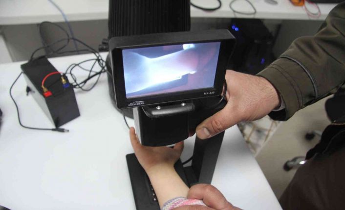 Ebe olan eşinin sözüyle başladı, damar yolu görüntüleme cihazı üretti