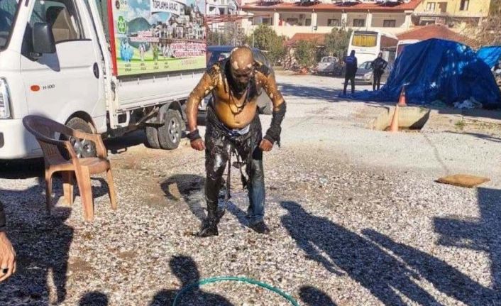 Her yeri yandı, hiçbir şey olmamış gibi derdini anlatmaya çalıştı