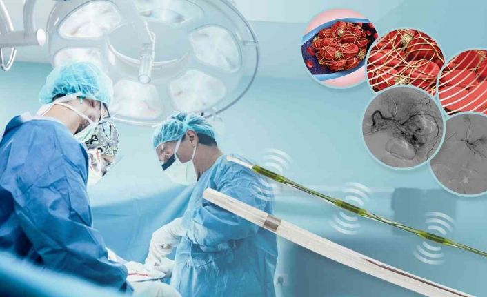 Derin Ven Trombozu tedavisinde yeni dönem: Viper Ultrasonik Farmakomekanik Tromboliz sistemi
