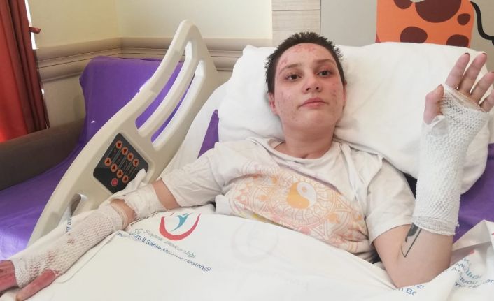 Kafe yangınında ağır yaralanan genç kız: “Son 2 ayı hatırlamıyorum”