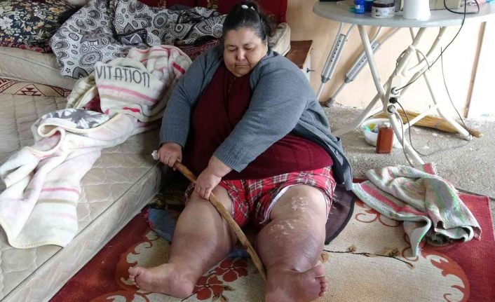 Tek odalı evde hasta anneye engelli oğlu, devlet ve komşuları bakıyor