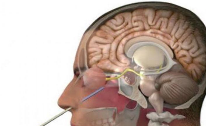 Yalova’da İlk kez Özel Atakent Hastanesi’nde kapalı yöntemle endoskopik hipofiz cerrahisi uygulandı