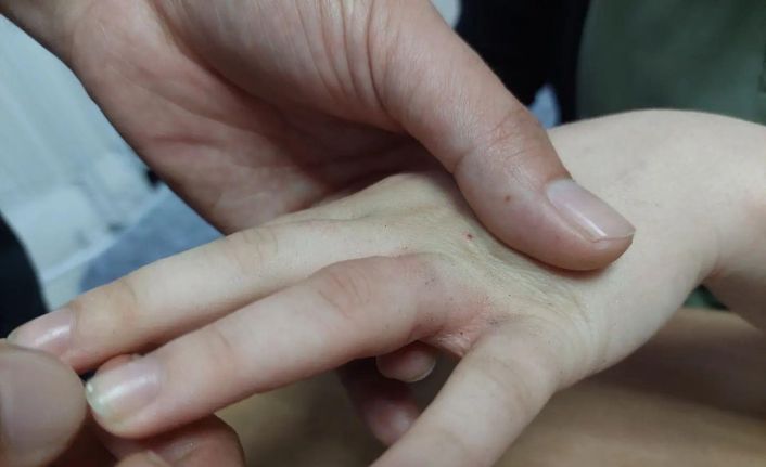 15 yaşındaki gencin parmağına sıkışan yüzüğü AFAD ve sağlık ekipleri çıkardı