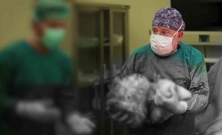 Kadın hastanın karnından 16,9 kiloluk dev kitle çıktı, 40 yıllık doktor bile şaşırdı