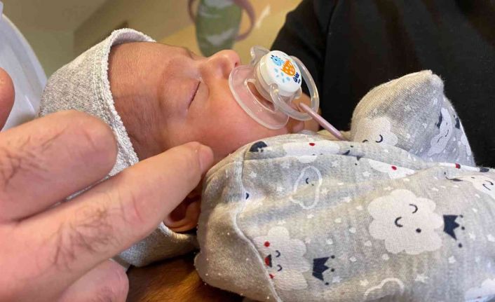 40 bin doğumda bir görülen hastalığa yakalanan bebek başarıyla tedavi edildi