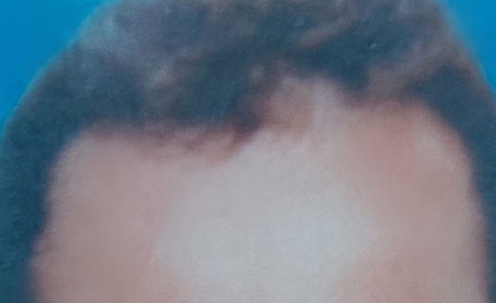 Balkonda düşen şahıs hayatını kaybetti