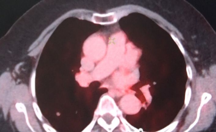 Diyarbakır’da kanser hastaları son nükleer tıp teknolojileriyle şifa buluyor