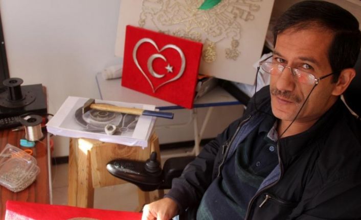 500 gün hastanede yattı, sanatla hayata tutundu